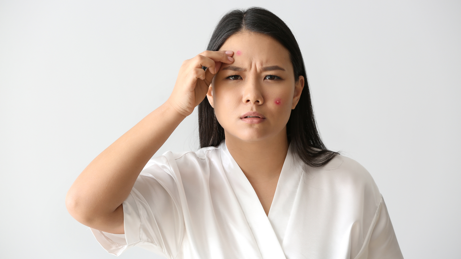 多囊卵巢症可致暗瘡體毛多